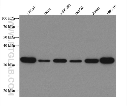 [80208-1-RR-100UL] RPS6 Recombinant antibody