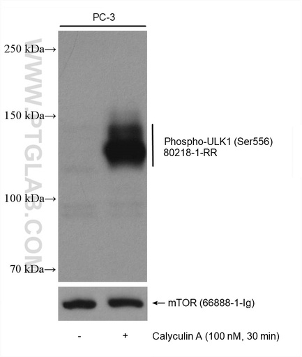 [80218-1-RR-100UL] Phospho-ULK1 (Ser556) Recombinant antibody